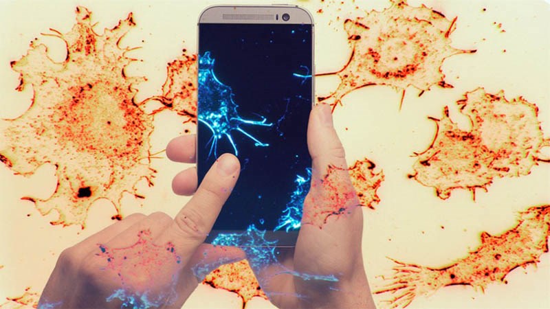 Phát hiện ung thư bằng smartphone: Điều không tưởng đang được hiện thực hóa